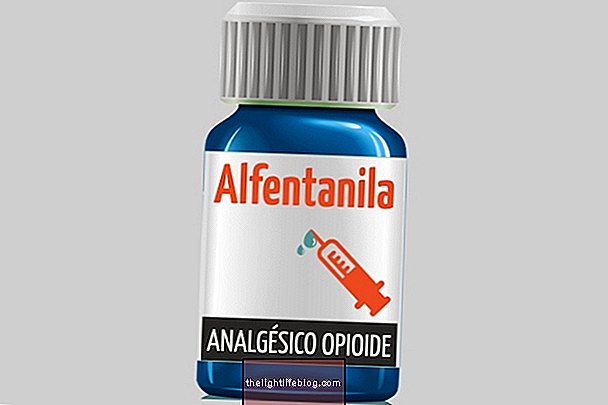 Alfentanila Opioid Analgesic Remedy