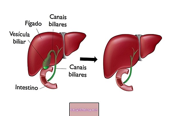 What is the gallbladder and what is its function