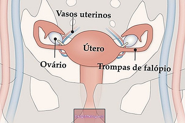 Pemindahan rahim: apakah itu, bagaimana ia dilakukan dan kemungkinan risiko
