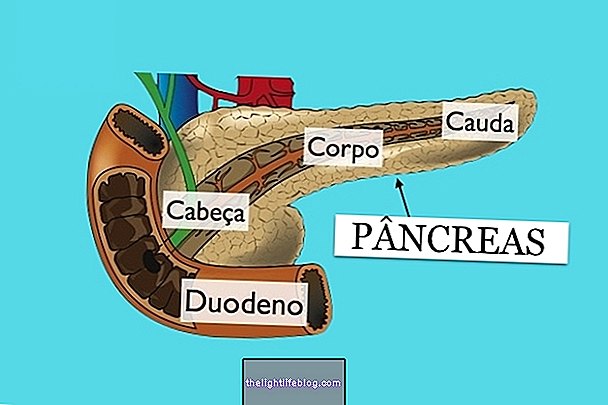 Chirurgia cancerului pancreatic