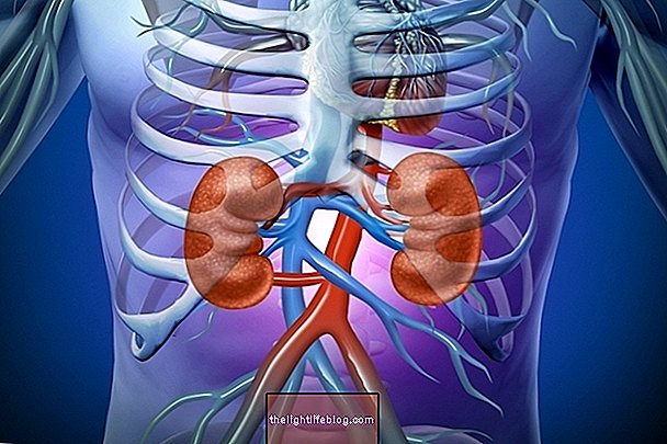 Renal failure: what it is, symptoms, causes and treatment