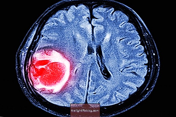Hvad er og hvordan man behandler cyste i hjernen