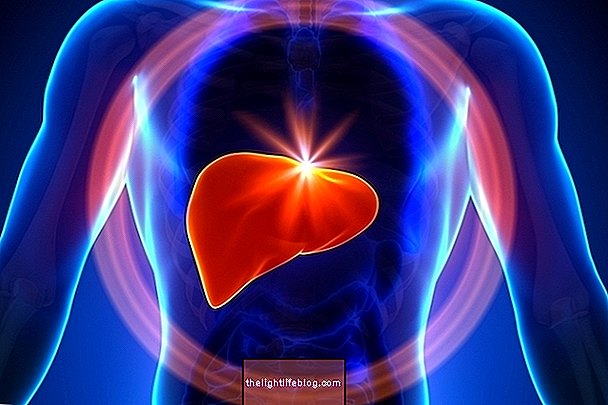 Liver tumor: what it is, symptoms and how treatment is done