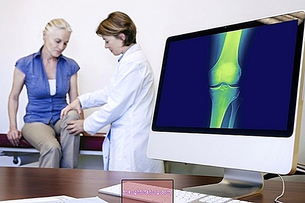 Osteomalacija: što je to, simptomi i liječenje