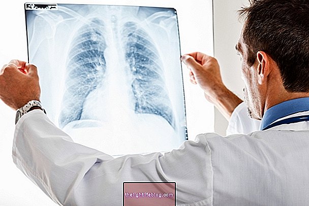 Was ist Bronchopneumonie und wie zu behandeln