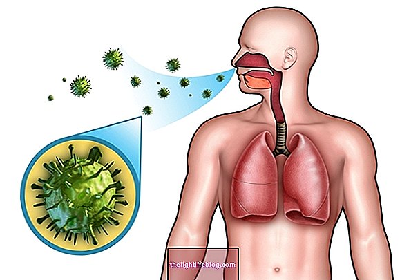 Community pneumonia: what it is, symptoms and treatment
