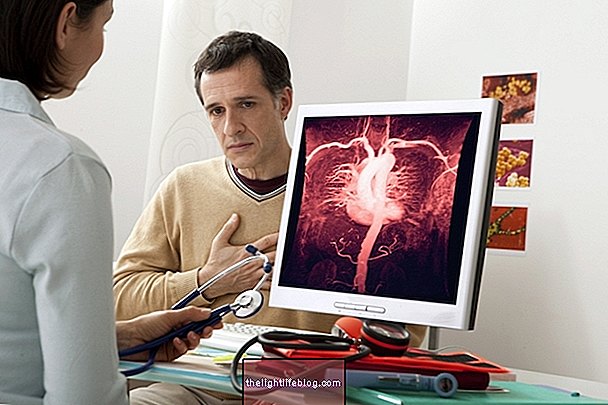 Angiotomography: what it is, what it is for and how to prepare