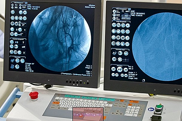 Mis on arteriograafia ja kuidas eksamit tehakse