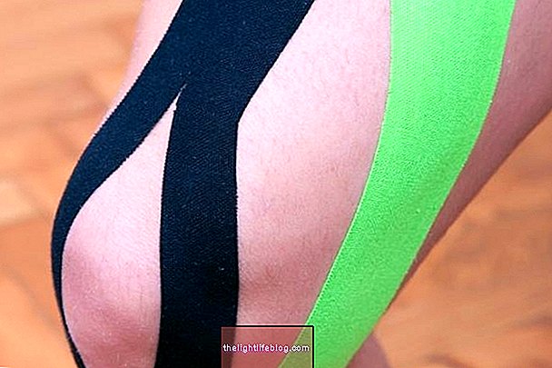 Kinesio tape: what it is, what it is for and how to use it