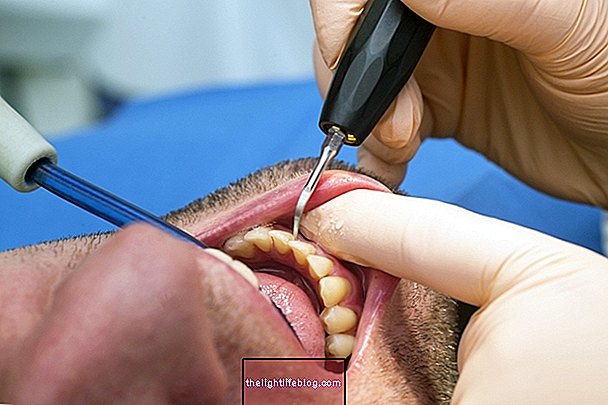 Hvordan er behandlingen for periodontitis