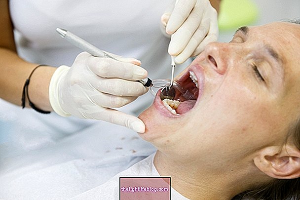 Kako prepoznati i spriječiti zubni kamenac