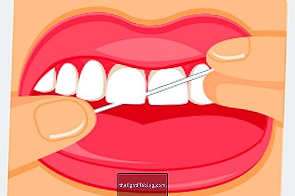 Kako ispravno koristiti zubni konac