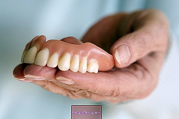 Denture: when to put, main types and cleaning