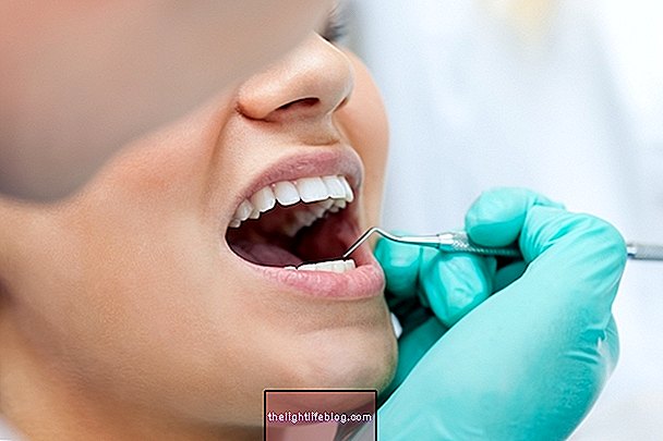 Tandekstraktion: hvordan man lindrer smerte og ubehag