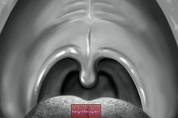Якою може бути шишка в порожнині рота і як лікувати