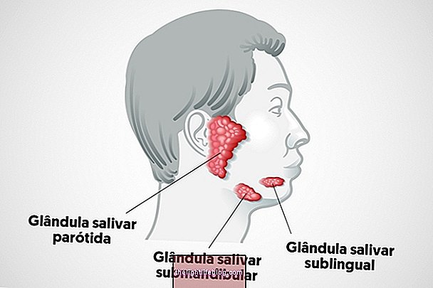 What are salivary glands, their function and common problems