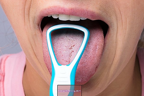 hammaslääketiede - Mille kielen kaavin on tarkoitettu ja miten sitä käytetään