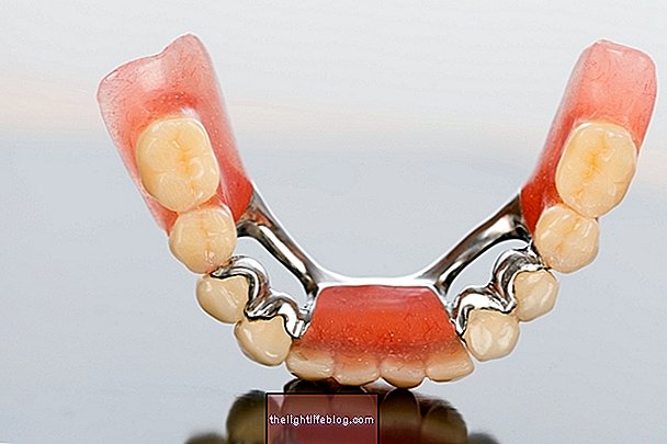 Vrste zubnih proteza i način njege