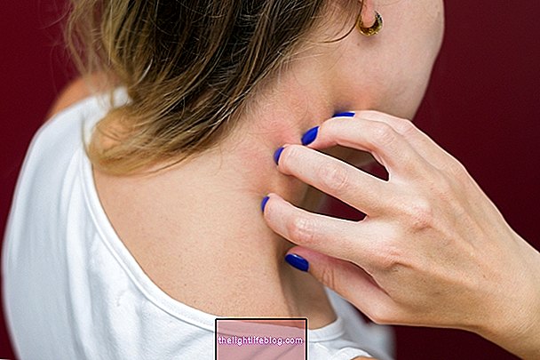 7 causes of itchy skin and what to do