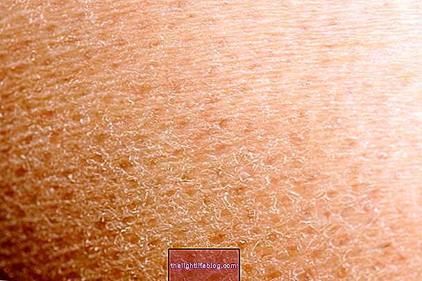 Лущення шкіри: 9 основних причин і що робити
