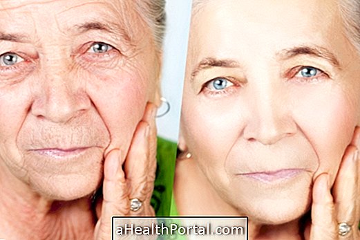 Chirurgia estetica per avere un viso più giovane senza rughe