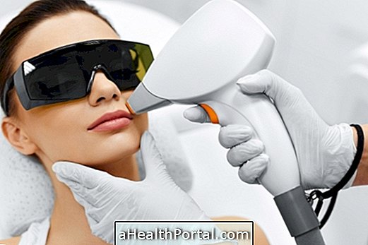 Laser treatments for the face