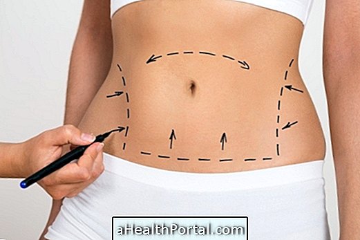 Abdominoplasty med Lipo - En lösning för att ha plagad mage