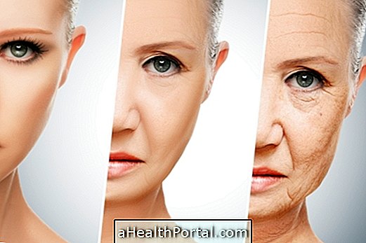 4 types of wrinkles and when they appear