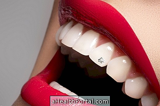 Was ist Zahnpiercing und wie soll ich es setzen?