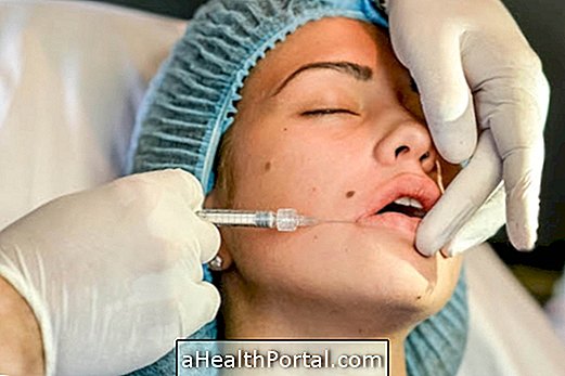 Plastische Operationen am Mund können die Lippen vergrößern oder verkleinern