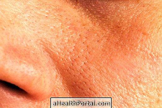 Comment fermer les pores dilatés du visage