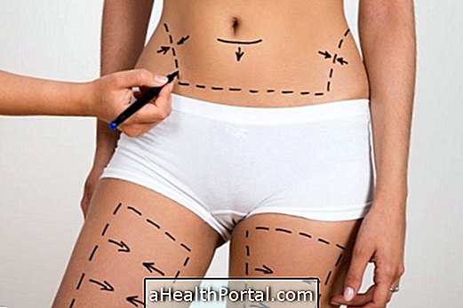 Bagaimana Liposuction Postoperative