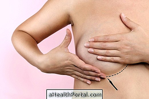 Top 4 Plastic Bryst Kirurgi Valg