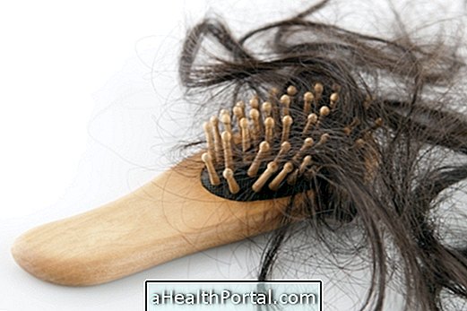 17-Alfa Estradiol - Traitement de perte de cheveux