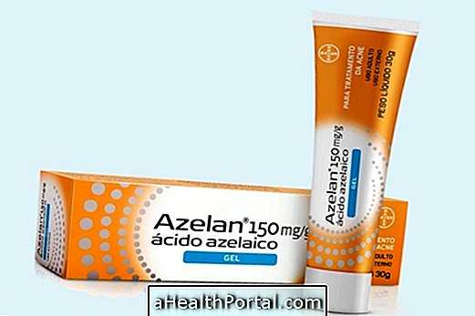 Kuidas Azelani võtta pimples