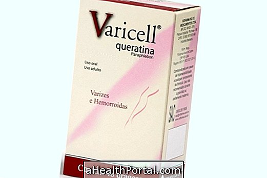Varicelle