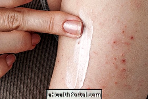 Tarfic: masť pri atopickej dermatitíde