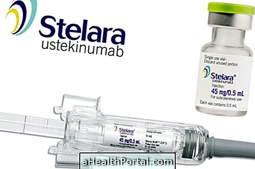 Stelara - Remède contre le psoriasis