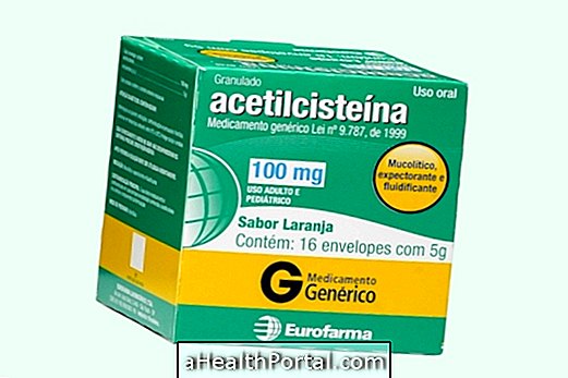 Kas yra acetilcisteinas ir kaip jis vartojamas