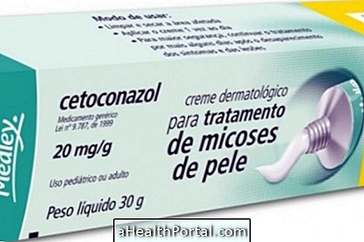 วิธีใช้ Ketoconazole - ครีมยาเม็ดและแชมพู