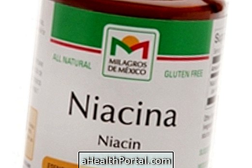 Niacin (nikotinska kiselina)