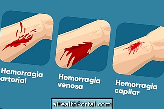 Hur man identifierar typer av blödning