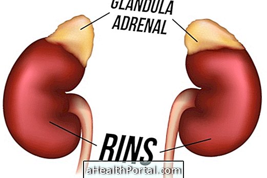 What is Adrenal Fatigue and How to Treat It