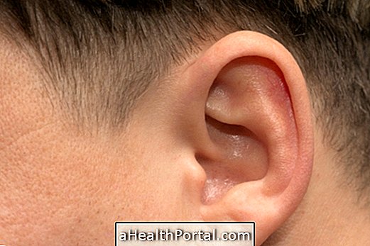 Pembedahan untuk membetulkan telinga
