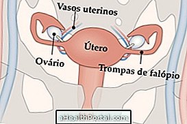 Transplant of uterus can help women become pregnant