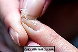 Weak nails: Know what can be