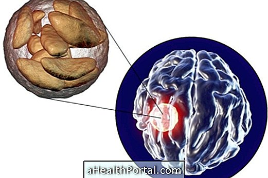 What is Brain Abscess and how to identify