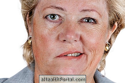Treatments for Bell's Palsy