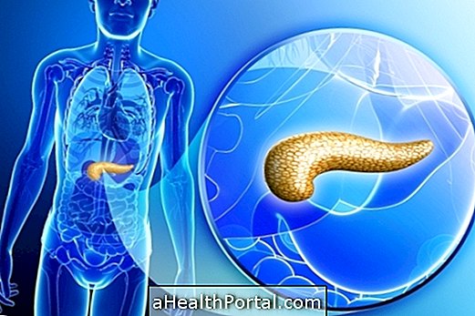 Pancreas के 4 प्रमुख रोग