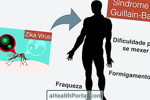 Zika kan forårsage svaghed og lammelse i benene